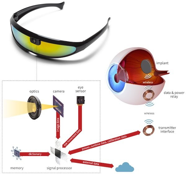 Stanford’s system for an artificial retina, which shares characteristic design elements to alternatives, such as glasses with a built-in camera, processing capability, and wireless transfer to the retina.&nbsp;