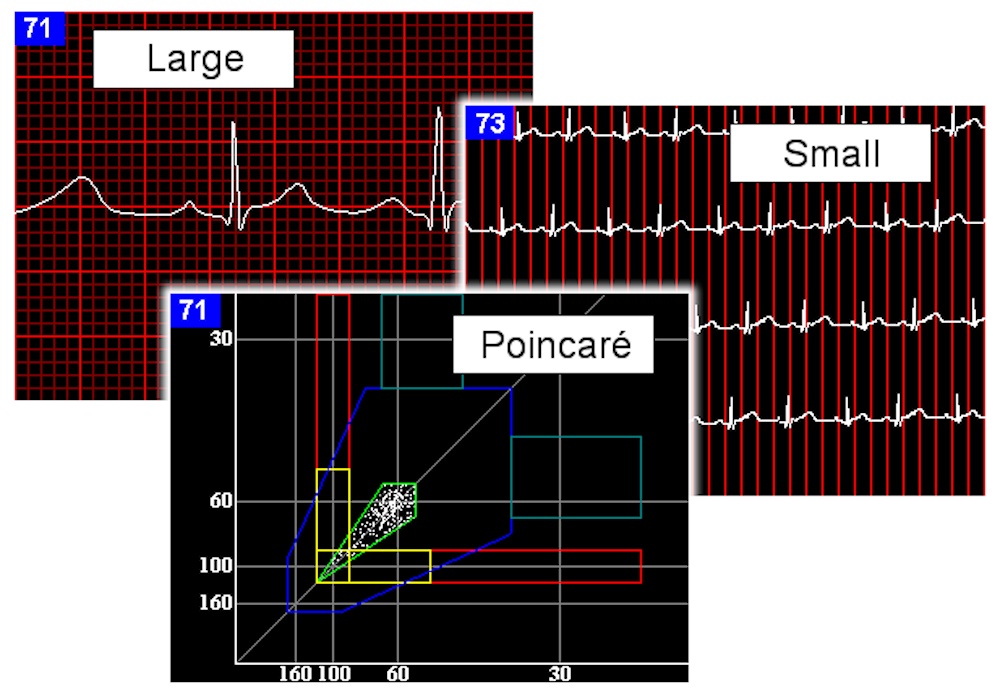 Hyperedge- , PCB Design, Hardware Design, Electronics Design, Hyperedge- . IoT, Embedded Systems, Artificial Intelligence,