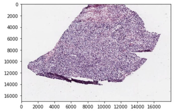 Build a scalable machine learning pipeline for ultra-high resolution medical images using Amazon SageMaker