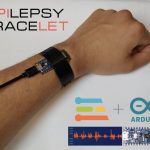 Epilet is a tinyML-powered bracelet for detecting epileptic seizures
